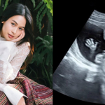 Maudy Ayunda Umumkan Kehamilan Anak Pertama, Bagikan Foto USG dan Baby Bump