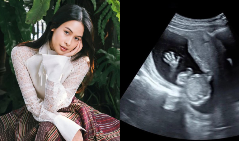 Maudy Ayunda Umumkan Kehamilan Anak Pertama, Bagikan Foto USG dan Baby Bump